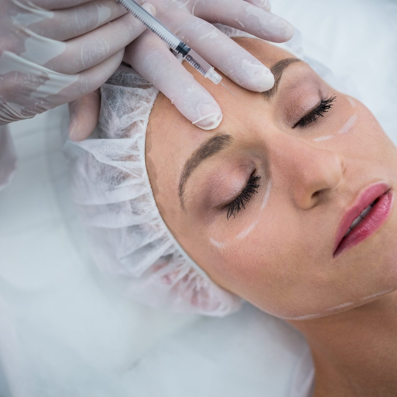 Botoks – Ars Longa Clinic