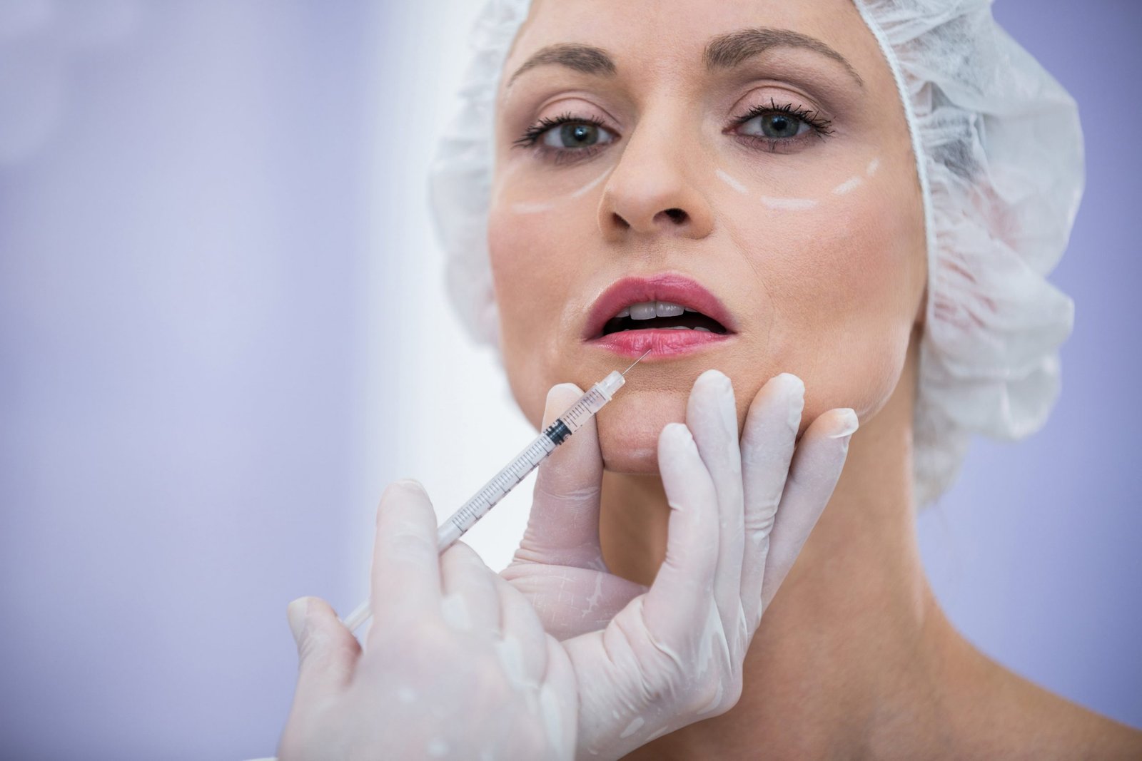 Botoks – Ars Longa Clinic